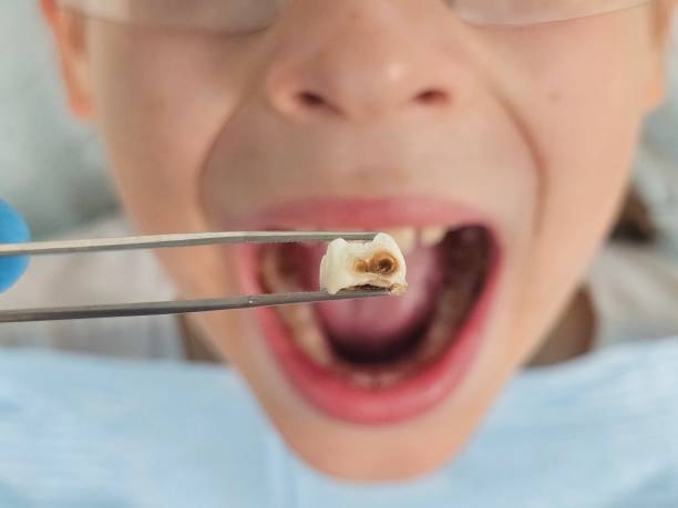 Urgent Tooth Repair in TN